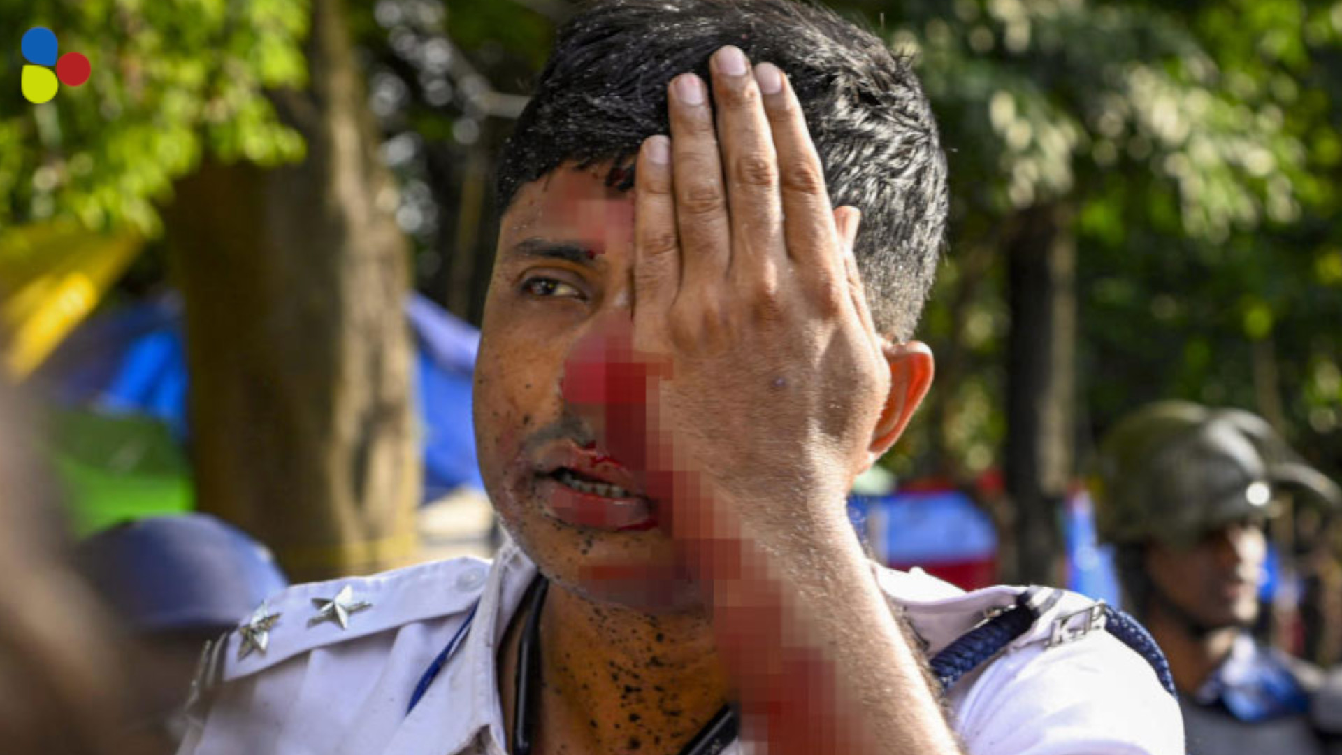 নবান্ন অভিযানে ইটের আঘাত! একচোখের দৃষ্টি চিরতরে হারালেন এই পুলিশকর্মী?