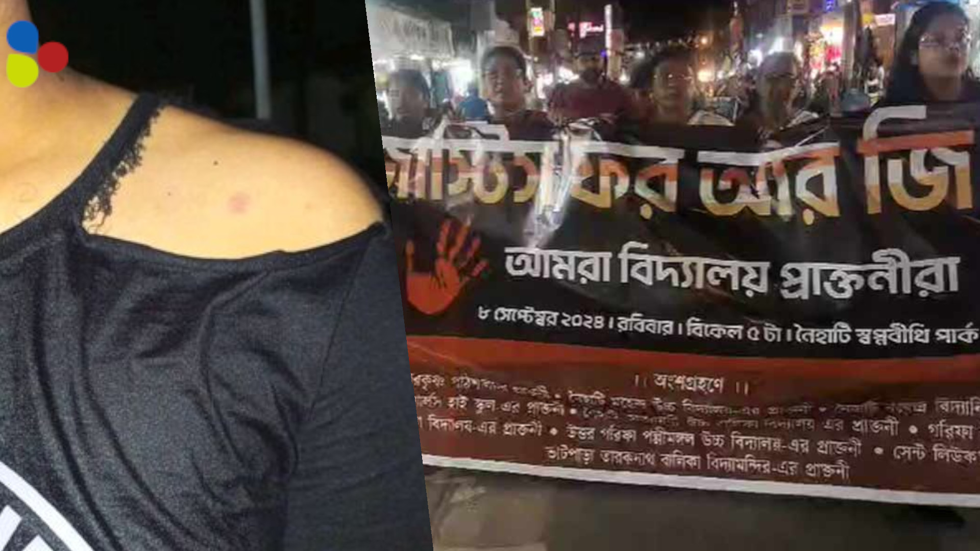 নৈহাটিতে মিছিলে ঢুকে মেয়েদের পোশাক ছেঁড়া, স্লোগানে বাধা! নেপথ্যে তৃণমূল?
